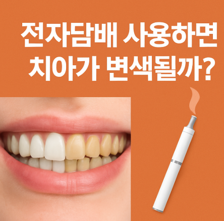 전자담배 치아 변색? 니코틴 착색의 진실과 예방법